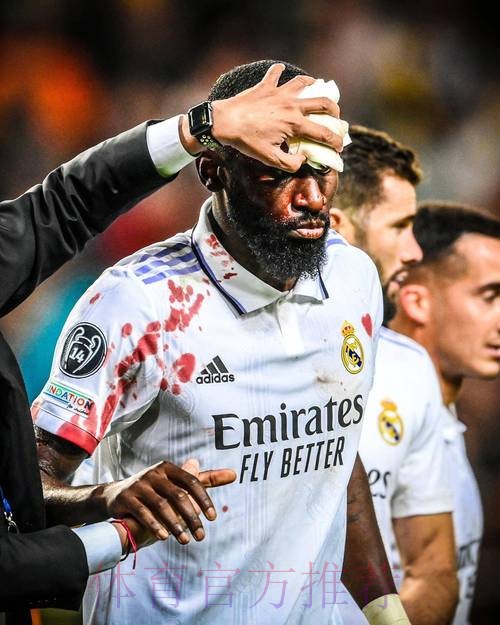 科贝:马里亚诺进入伤病名单 克罗斯等5将继续伤缺 科贝:马里亚诺进入伤病名单 克罗斯等5将继续伤缺